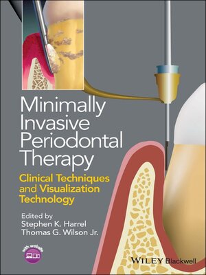 cover image of Minimally Invasive Periodontal Therapy